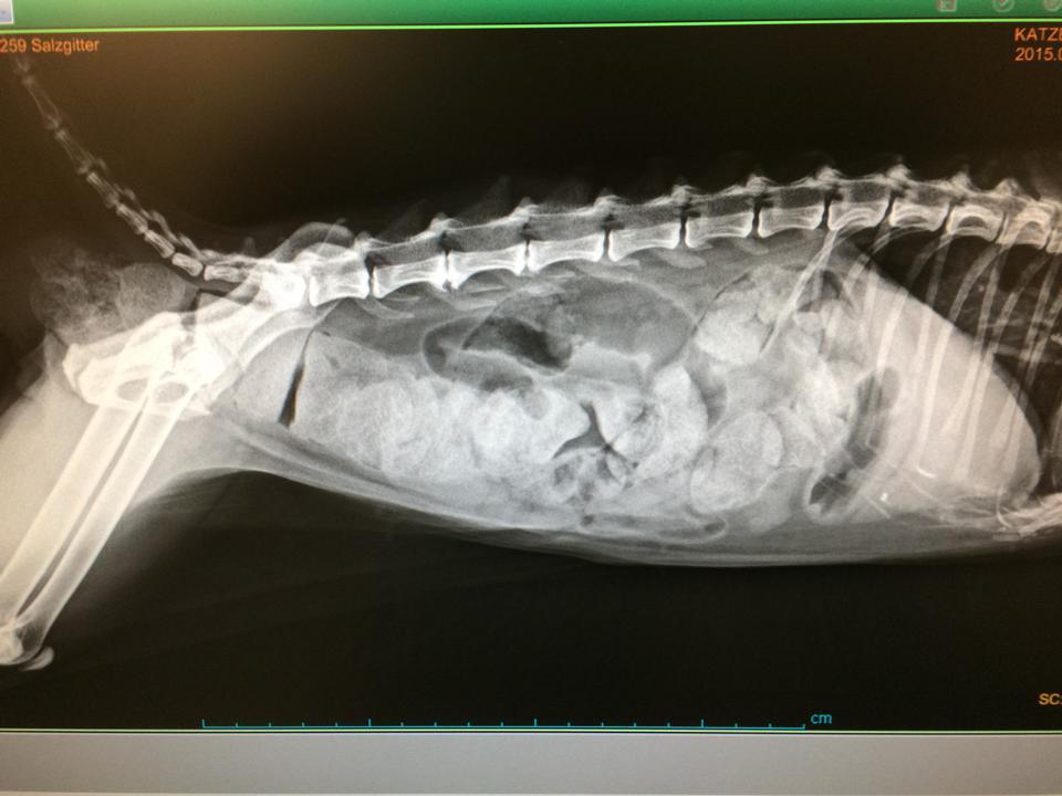 Megacolon